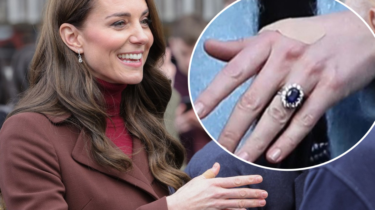 Ducesa Kate poartă petice pe mâini.  De ce?  video